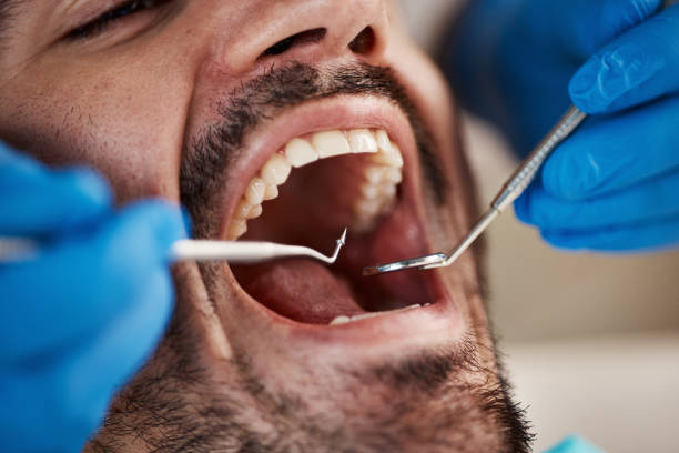 Best Pediatric Emergency Dentist in Amelia, OH