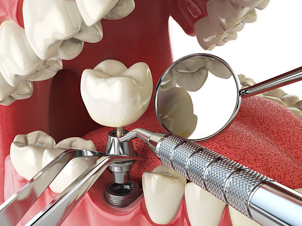 Best Orthodontic Emergency Dentist in Amelia, OH